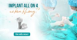 Implant All on 4 có bền không