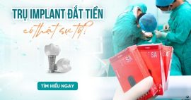 implant đắt tiền có thật sự tốt không