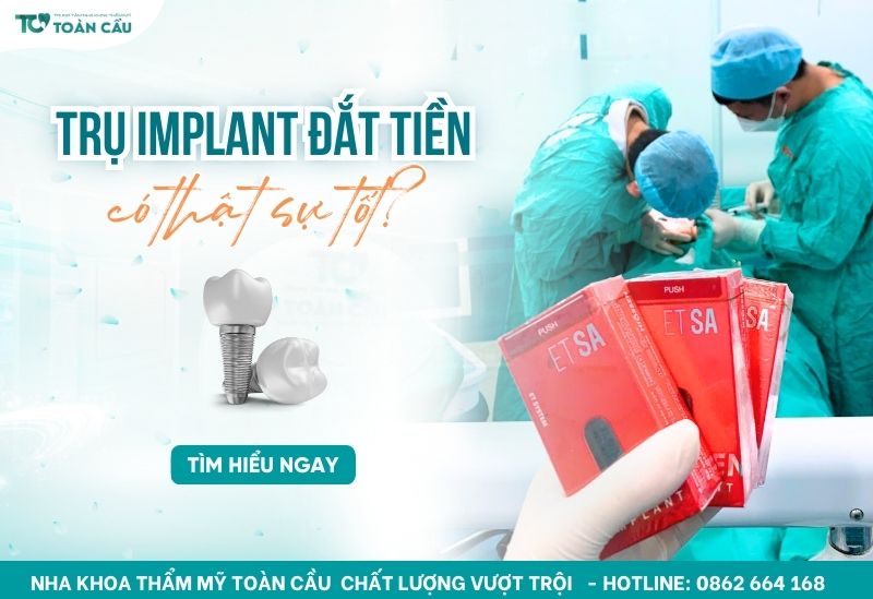 implant đắt tiền có thật sự tốt không