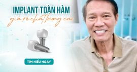 nha khoa cấy ghép implant toàn hàm giá rẻ