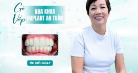 nha khoa implant an toàn Gò Vấp