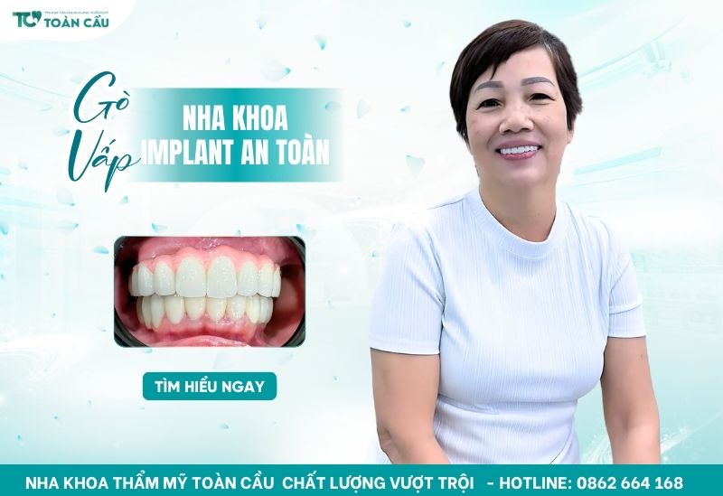 nha khoa implant an toàn Gò Vấp