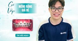 nha khoa niềng răng giá rẻ gần nhất