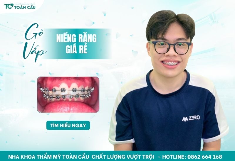 nha khoa niềng răng giá rẻ gần nhất
