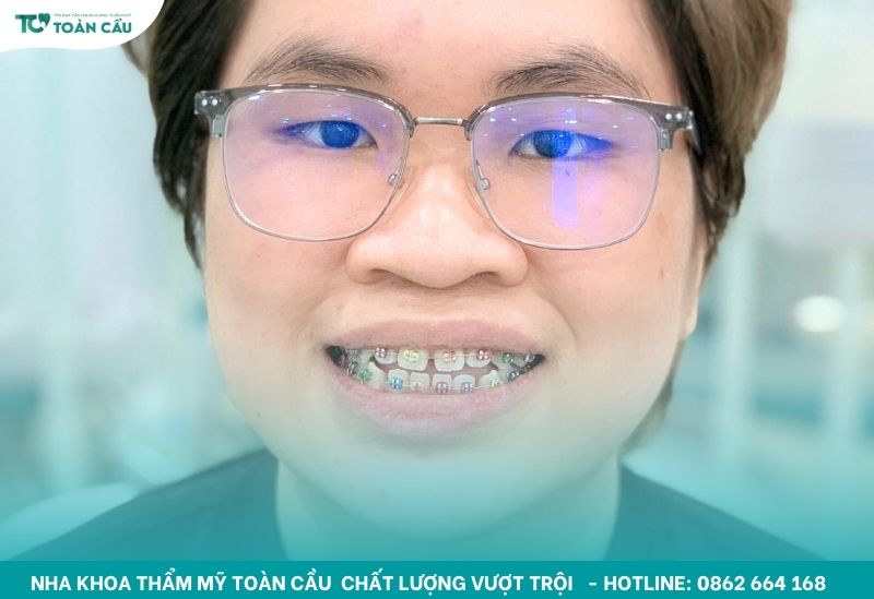 Nha khoa niềng răng giá rẻ gần nhất tại khu vực Gò Vấp