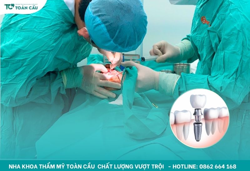 Cấy ghép Implant là một khoản đầu tư lâu dài
