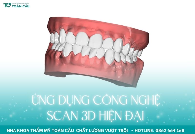 Ứng dụng công nghệ scan 3D hiện đại