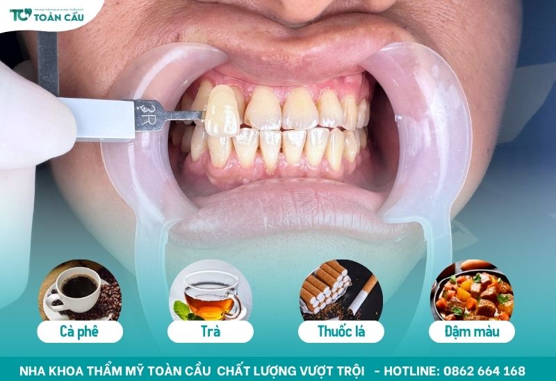Răng bị xỉn màu do các loại thực phẩm có màu đậm