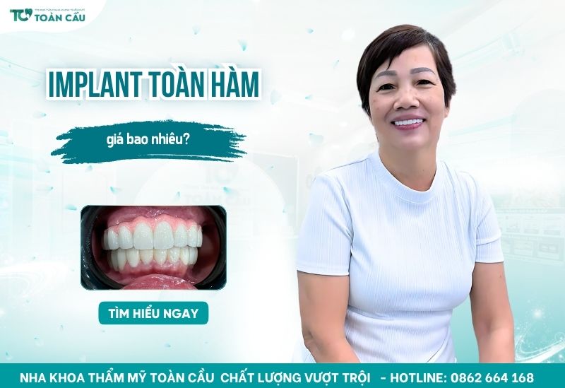 Trồng răng implant toàn hàm giá bao nhiêu