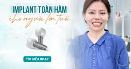 trồng răng toàn hàm cho người lớn tuổi