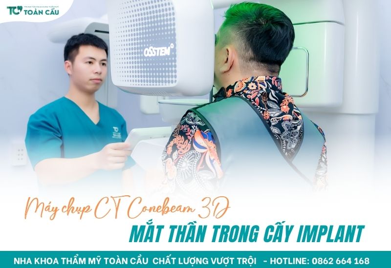 Top 7 nha khoa cấy ghép implant All on 6 giá tốt tại Gò Vấp 7 Cấy ghép implant All on 6 cần công nghệ hiện đại