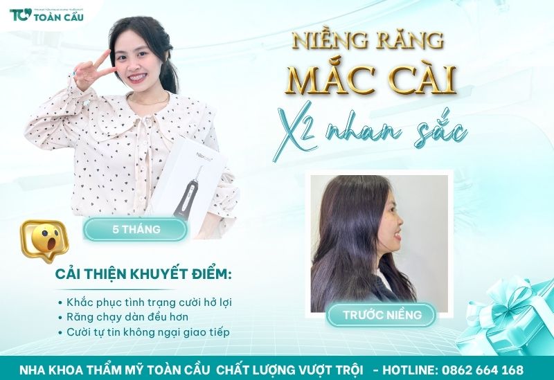 Chỉnh nha HCM mang lại nụ cười đẹp cho mọi lứa tuổi 5 Cải thiện thẩm mỹ nụ cười