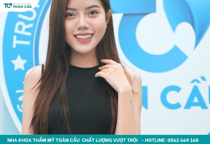 Cách chỉnh răng mọc lệch không cần niềng hiệu quả 8 Khách hàng dán sứ Veneer