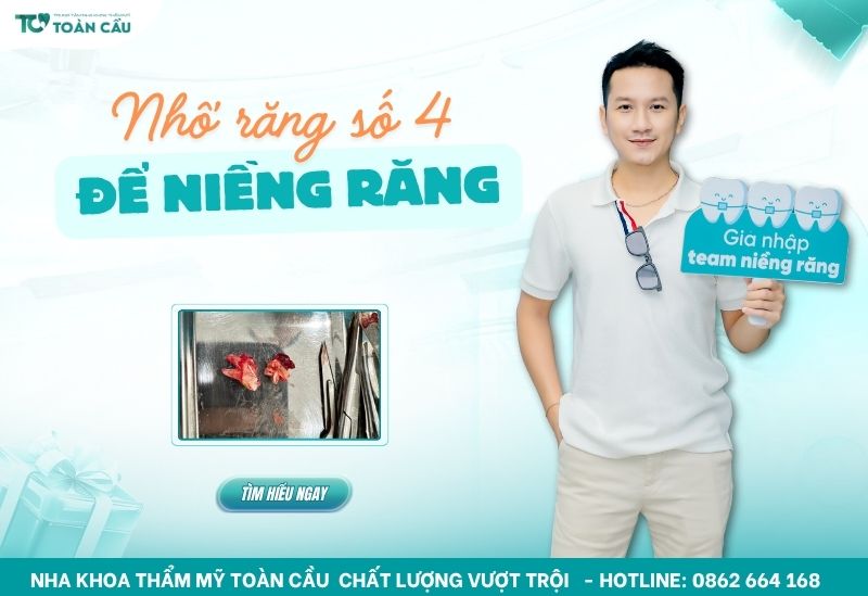 Có nên nhổ răng số 4 để niềng không