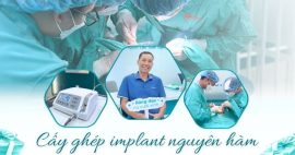 giải pháp khắc phục mất răng toàn hàm