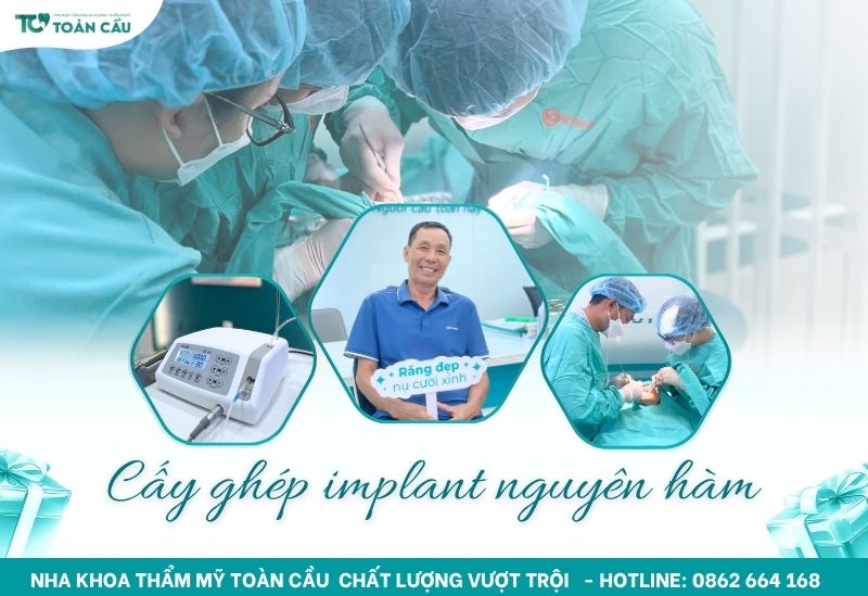 giải pháp khắc phục mất răng toàn hàm
