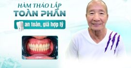 hàm tháo lắp toàn phần