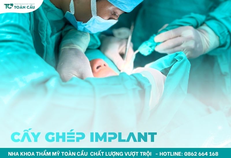 Cấy ghép implant không cần ghép xương tại nha khoa uy tín 5 Cấy ghép implant an toàn
