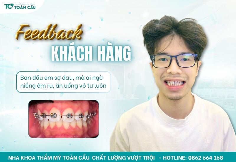 Khách hàng niềng răng thành công