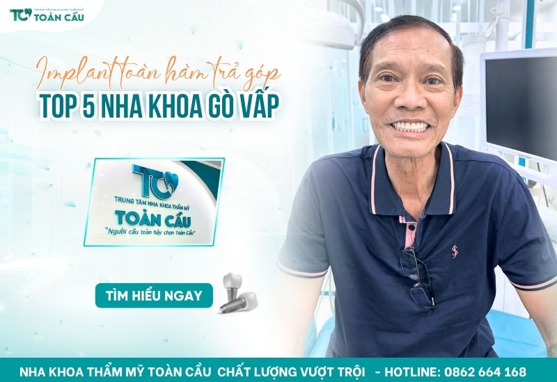 nha khoa trồng răng implant toàn hàm trả góp