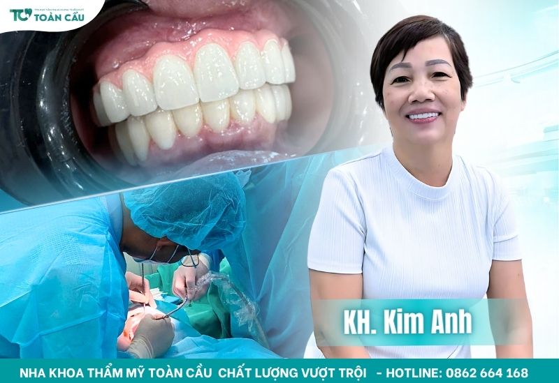 Top 5 nha khoa trồng răng implant toàn hàm trả góp Gò Vấp 5 Khách hàng cấy ghép implant tại Toàn Cầu