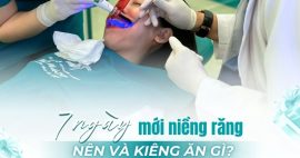 Niềng răng ăn gì