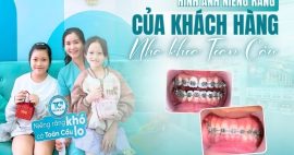 niềng răng đẹp