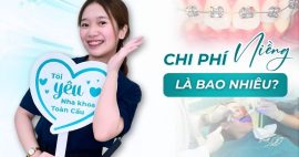 Niềng răng giá bao nhiêu