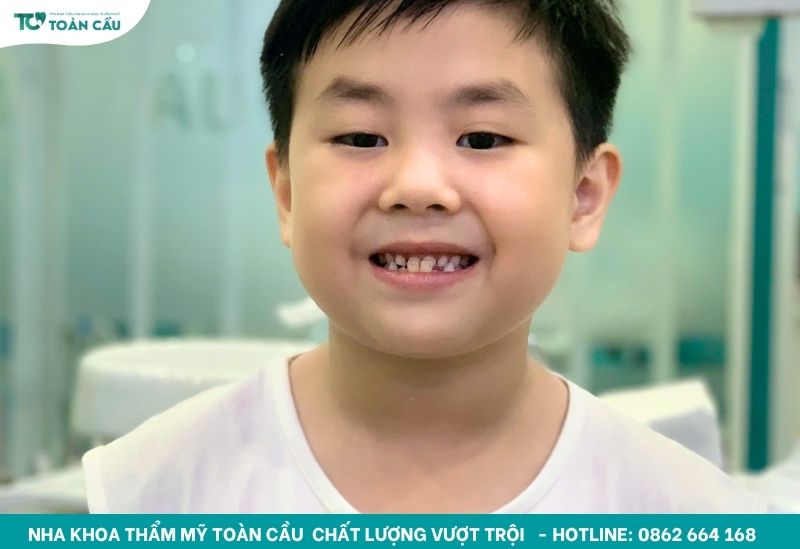 Top 5 địa chỉ niềng răng giá rẻ TPHCM tốt và uy tín 6 Trẻ em tiền chỉnh nha an toàn
