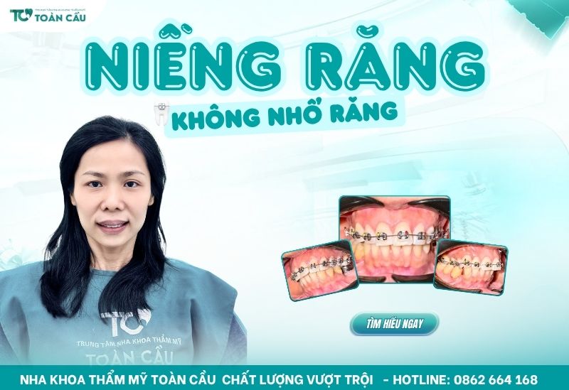 niềng răng không nhổ răng