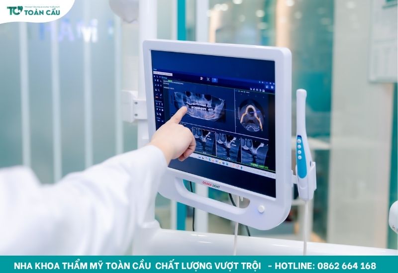 Địa chỉ niềng răng rẻ nhất tại Gò Vấp bạn cần biết 10 Phim 3D giúp chẩn đoán chính xác hơn