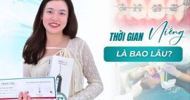 Niềng răng thưa mất bao lâu