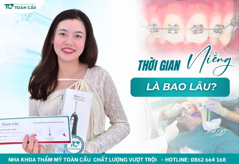 Niềng răng thưa mất bao lâu