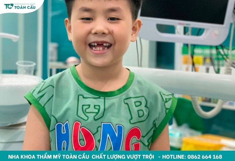 Niềng răng thưa mất bao lâu thì có được hiệu quả? 6 Độ tuổi lý tưởng để niềng răng là từ 11 – 16 tuổi