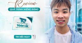 Quá trình niềng răng