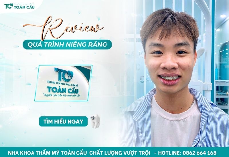 Quá trình niềng răng