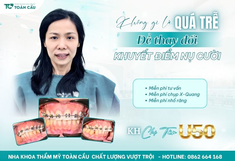Quá trình niềng răng ở nha khoa uy tín diễn ra như thế nào? 8 Khách hàng niềng răng tại nha khoa