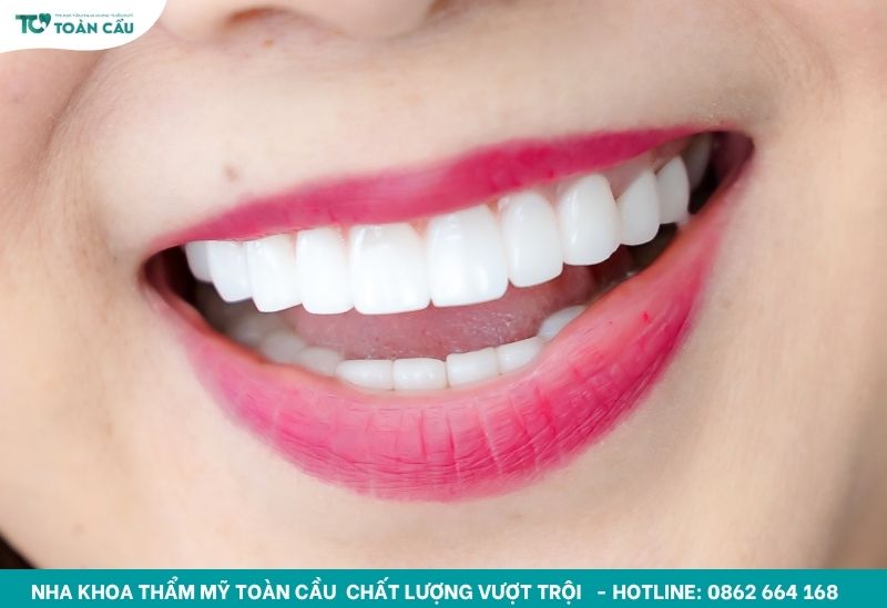 Vì sao răng sứ không đen viền là lựa chọn số 1 dành cho bạn? 7 Răng sứ đẹp