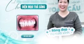 răng sứ thẩm mỹ
