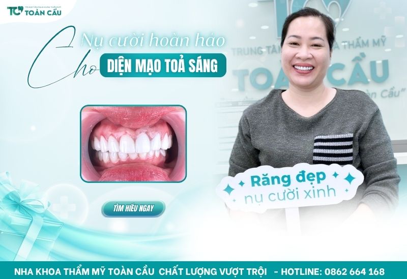 răng sứ thẩm mỹ