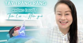 Tẩy trắng răng không ê buốt