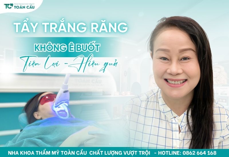 Tẩy trắng răng không ê buốt