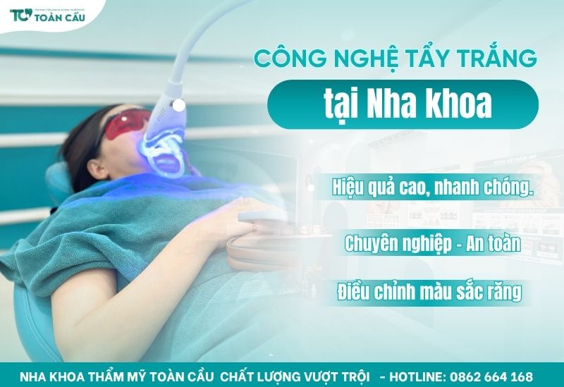 Tẩy trắng răng không ê buốt, hiệu quả tại nha khoa uy tín 7 Địa chỉ tẩy trắng răng uy tín, không ê buốt