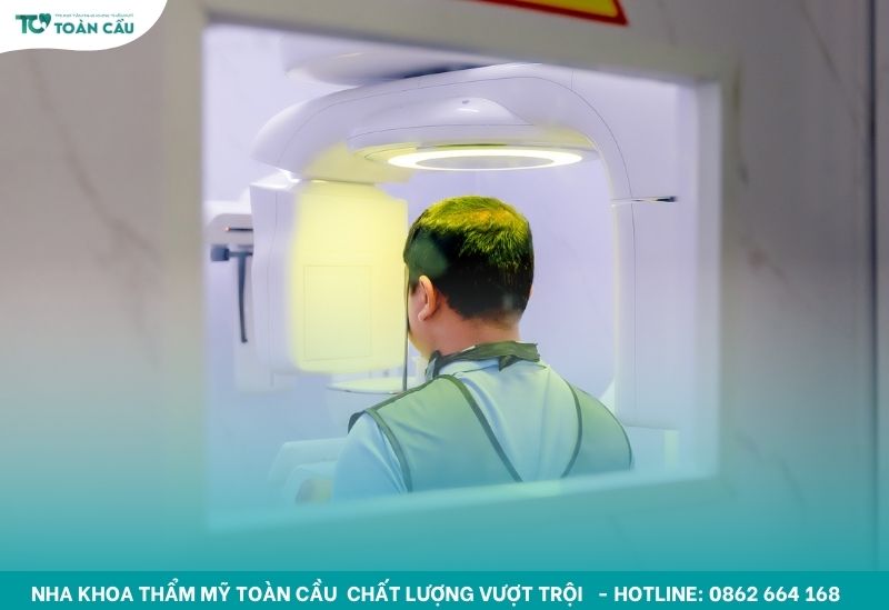 Trồng implant toàn hàm Gò Vấp trả góp linh hoạt tại Thẩm mỹ Toàn Cầu 8 Khách hàng chụp CT 3D tại nha khoa