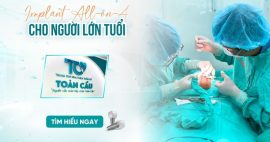 Trồng răng toàn hàm bằng phương pháp All on 4