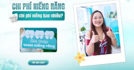 Chi phí niềng răng
