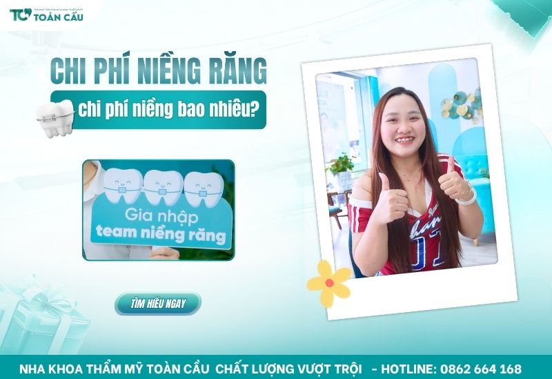 Chi phí niềng răng