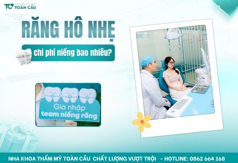 chi phí niềng răng hô nhẹ