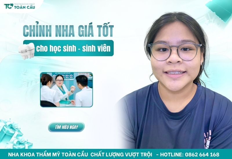 Chỉnh nha cho học sinh giá tốt