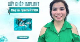 địa chỉ cấy implant gần đây
